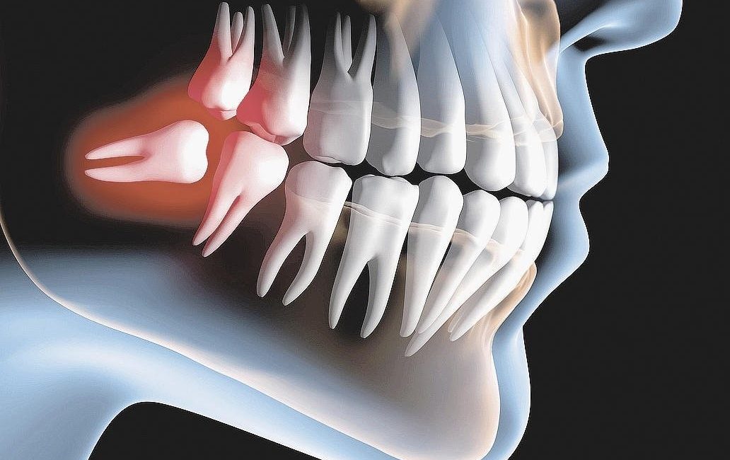 Как оценить состояние восьмерки